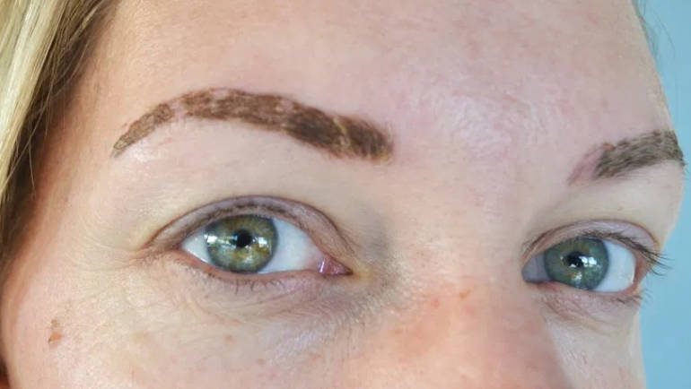 Αποθεραπεία μετά το microblading: Τι πρέπει να περιμένουμε!